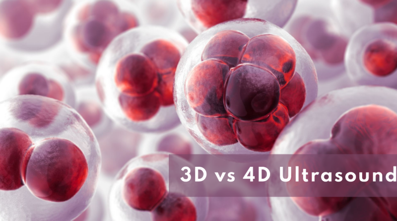 3D vs 4D Ultrasound