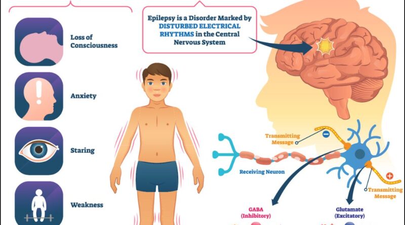 Epilepsy