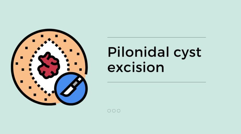 Pilonidal cyst excision