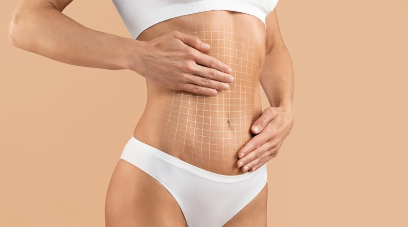 Tummy Tuck Dubai