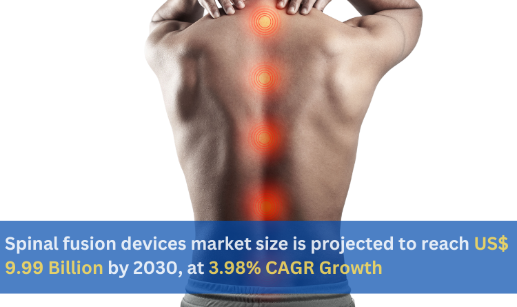Spinal fusion devices market size is projected to reach US 9.99 Billion by 2030 at 3.98 CAGR Growth – Renub Research