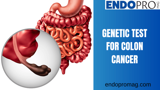 Genetic Test for Colon Cancer