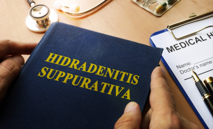 Hidradenitis Suppurativa Treatment