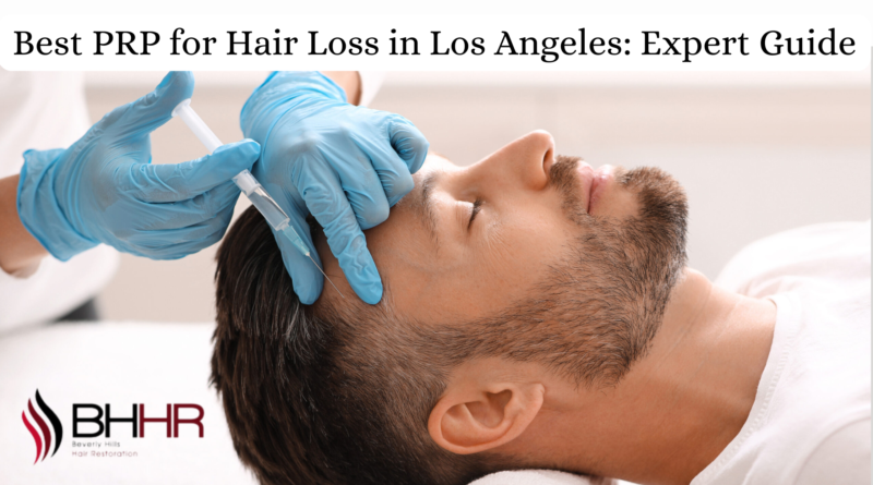 PRP for hair loss los angeles