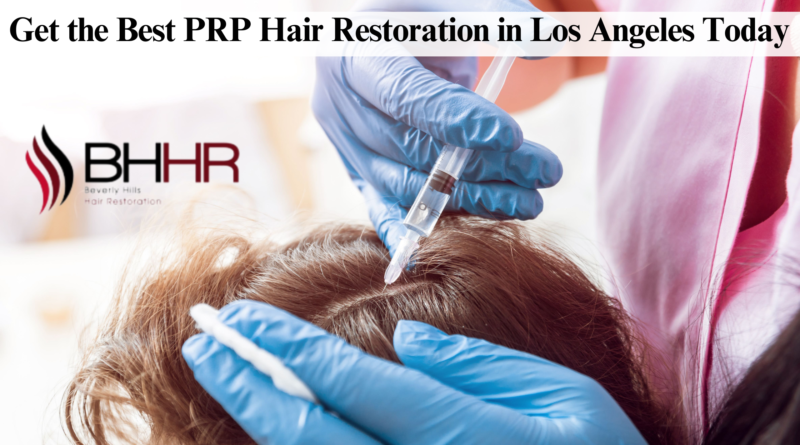 best prp hair restoration los angeles