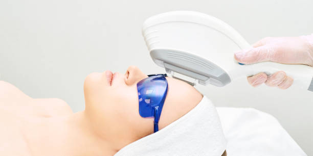 Laser acne scar treatment in Abu Dhabi