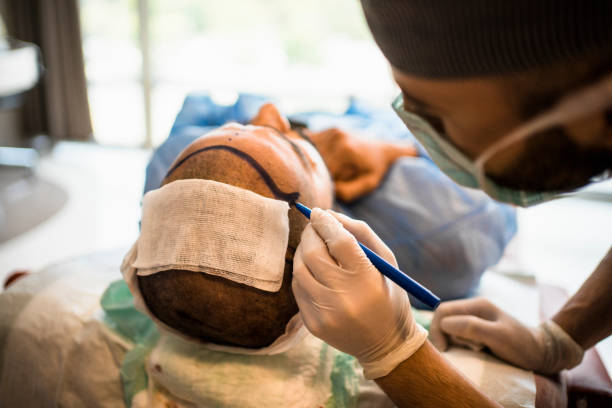 Female Hair Transplant in Abu Dhabi