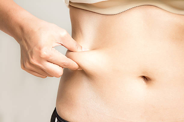 Liposuction in Al Ain