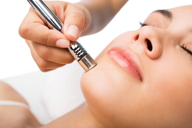 Microdermabrasion treatment in Abu Dhabi