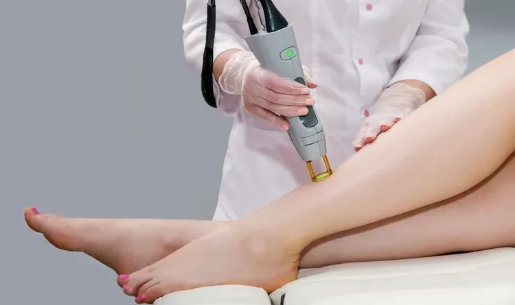 laser hair removal