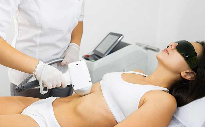 bikini laser hair removal