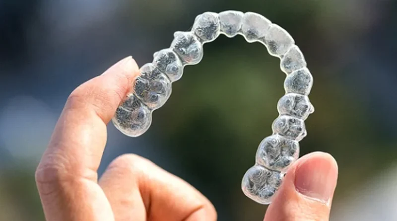 Clear Aligners in Glendale