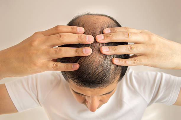 Hair Loss Treatments Tailored to Your Needs