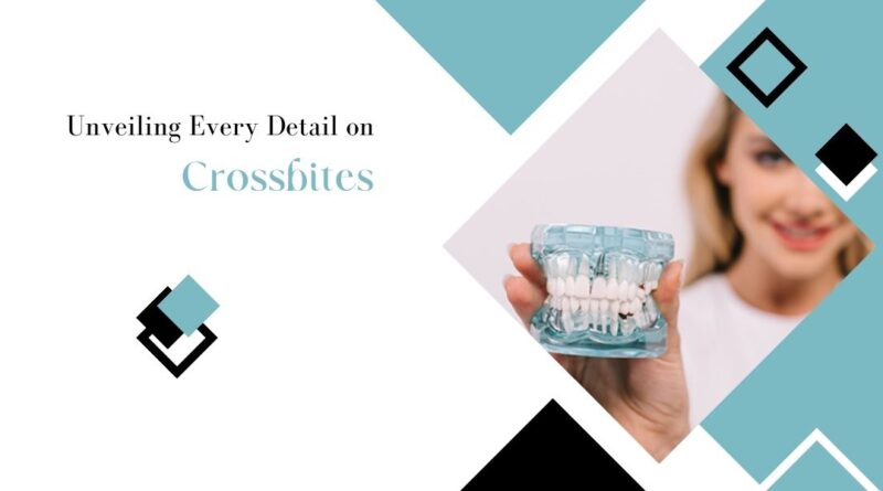 Unveiling Every Detail on Crossbites