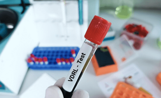 vdrl blood test