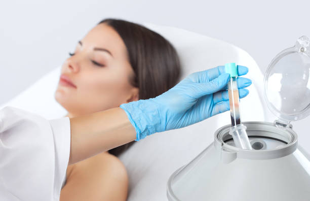 PRP Treatment in Abu Dhabi