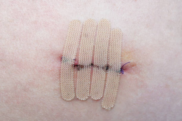 Surgical scar revision in Abu Dhabi