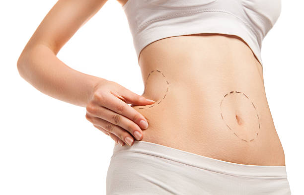 Liposuction Abu Dhabi