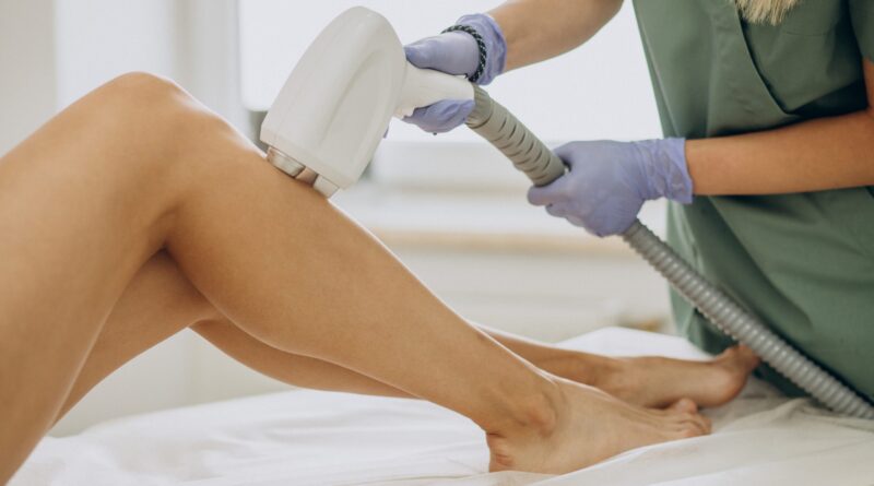 laser hair removal