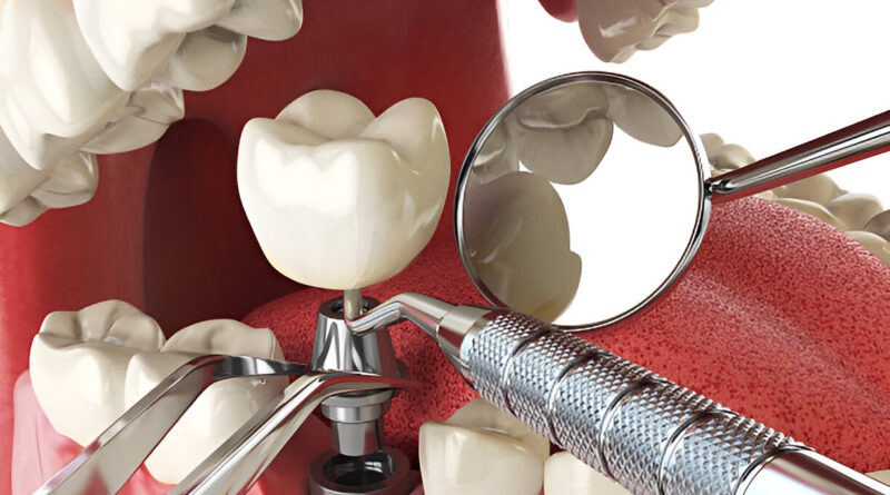 Traditional and Cosmetic dentistry